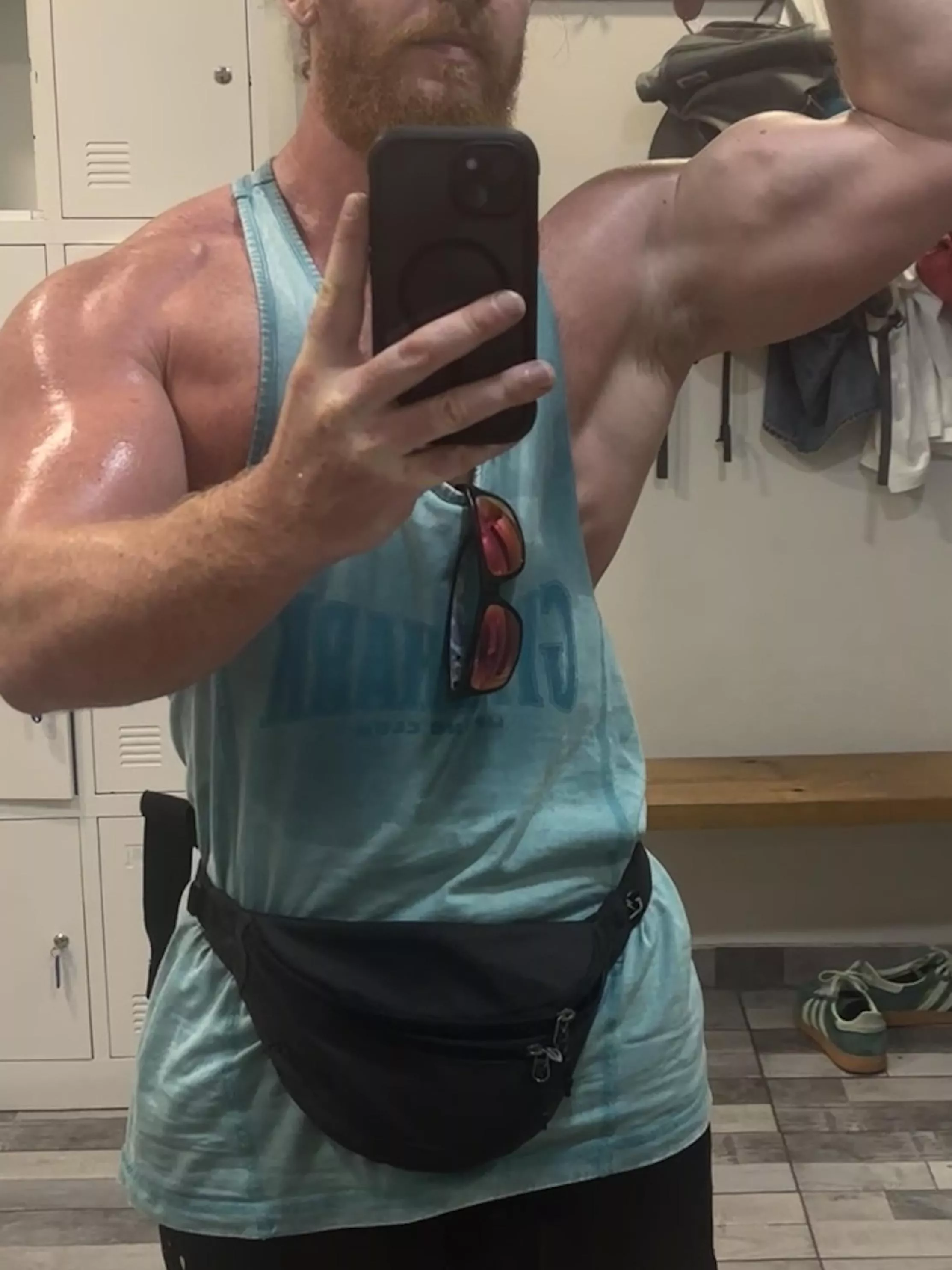 Super sweaty arm pit posted by Ok-Philosopher-9562