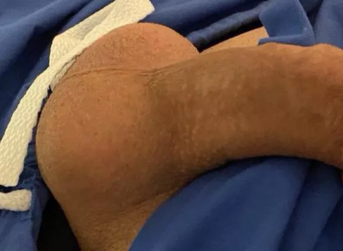 Young looking balls by SmoothInterest519