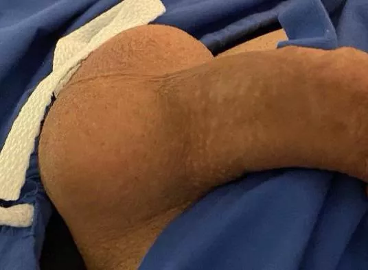 Young looking balls posted by SmoothInterest519