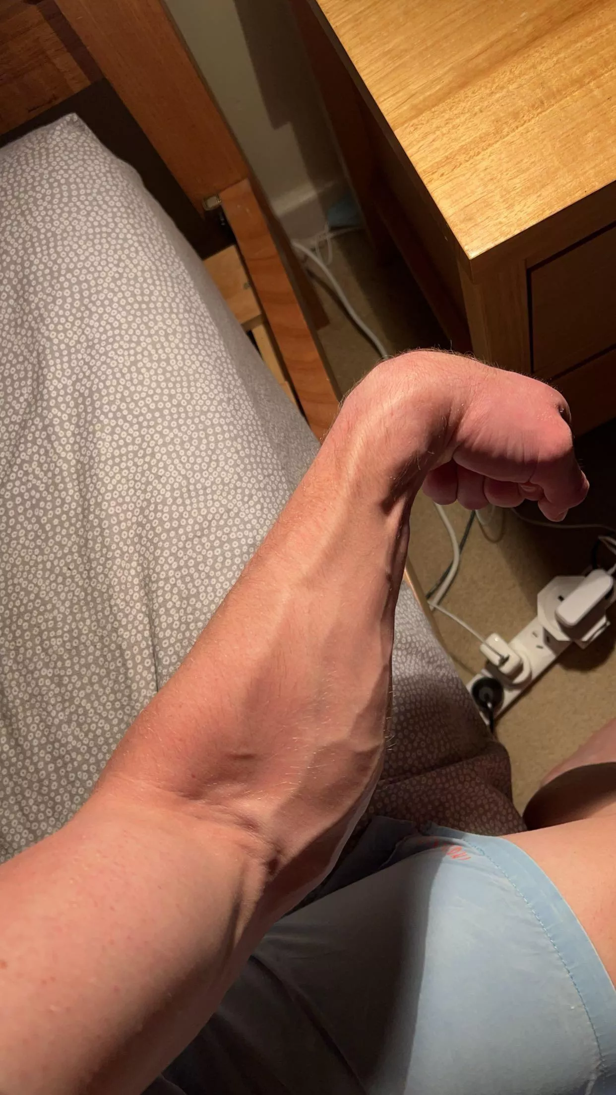 Forearm posted by Usual-Cress-8614