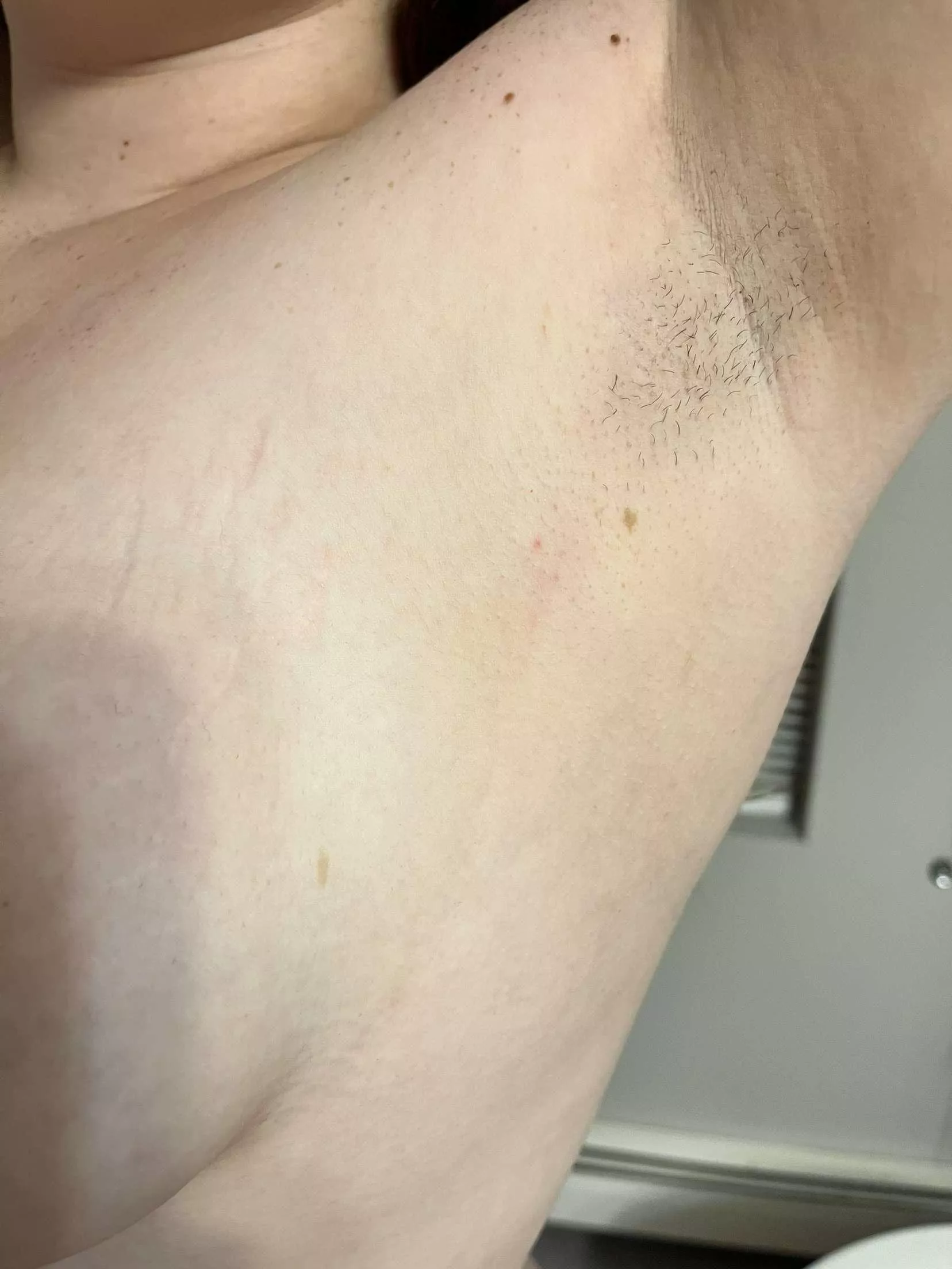 growing them out finally  posted by GoodGirlx00