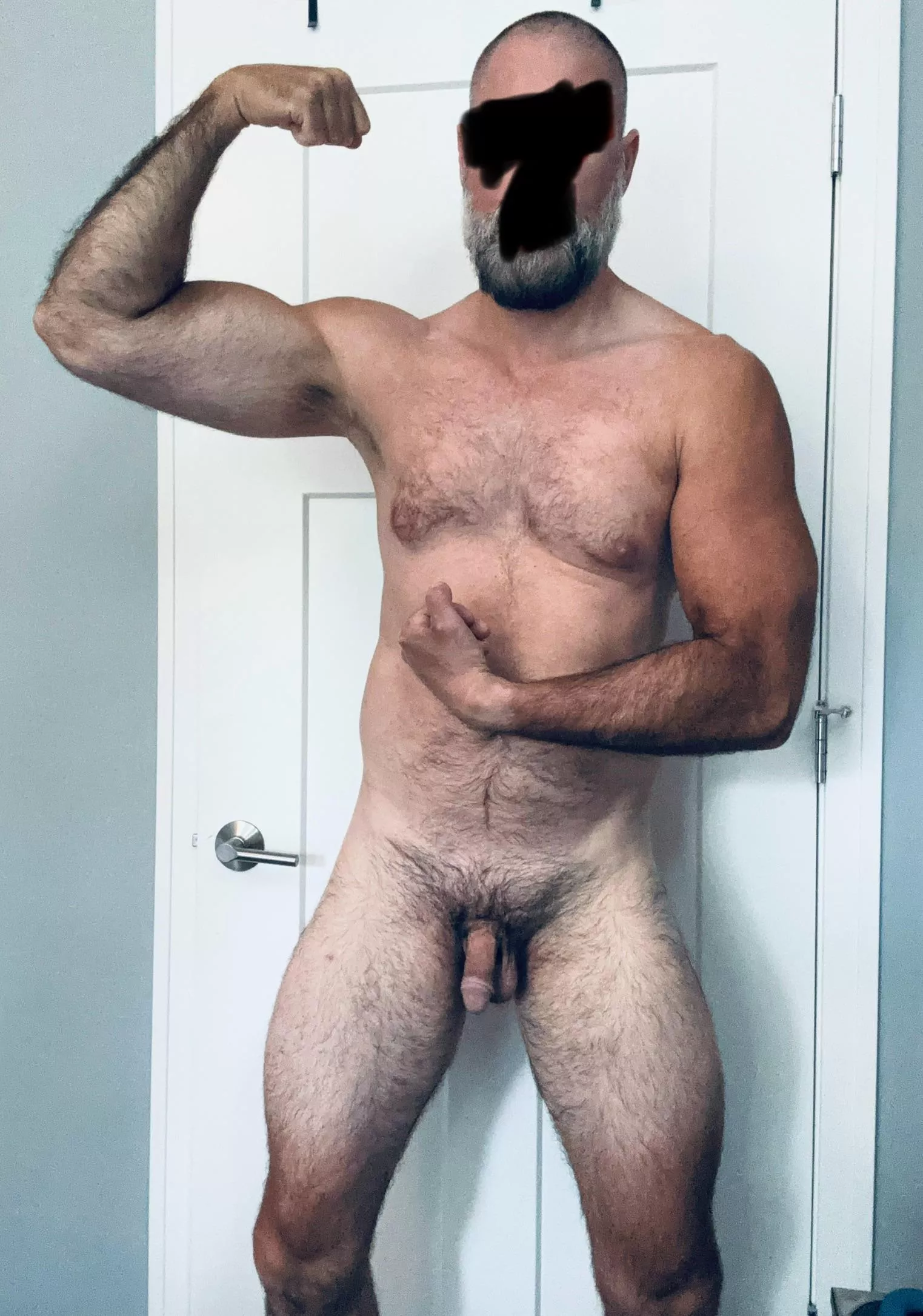 Hair everywhere  posted by BaldJack8000