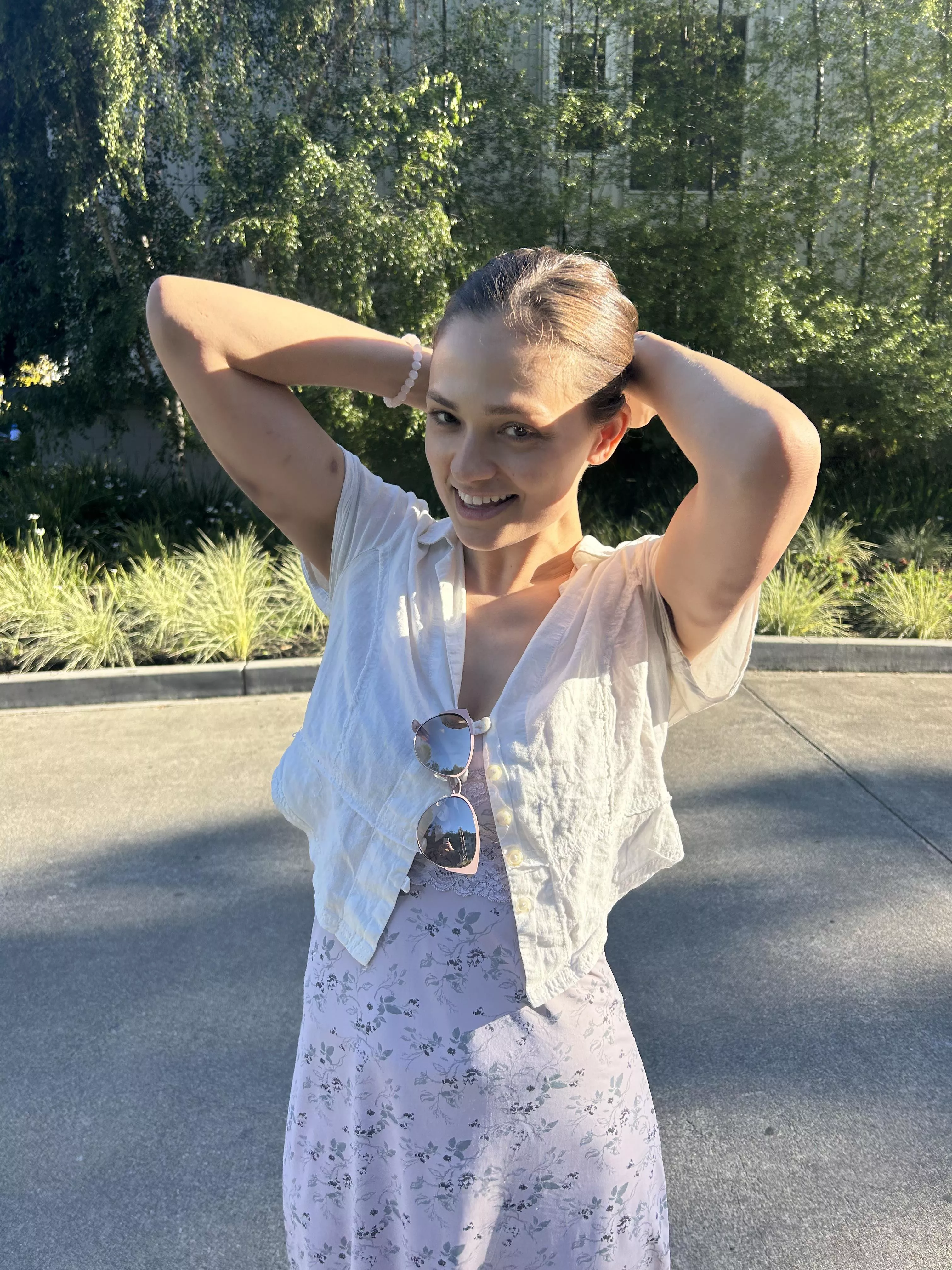 Love my marks secretly coming out of clothes :) posted by ShiftAccomplished579