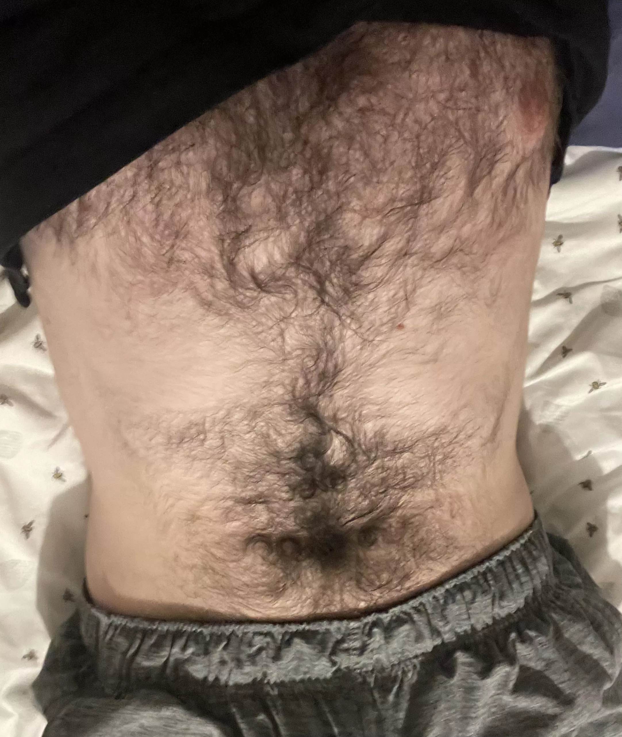 Only 20 and been this hairy for a while🤷🏼‍♂️ posted by Original-Issue999