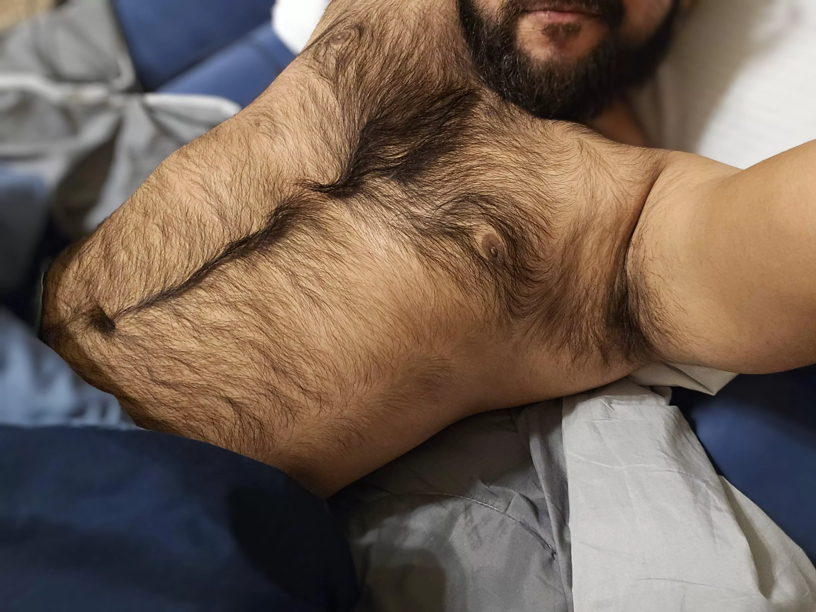 Volunteers needed to fix my happy trail! posted by CaptSchwanzKopf