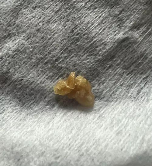 Plucked this out of my 9 month old’s nose this morning by Serendipityyy