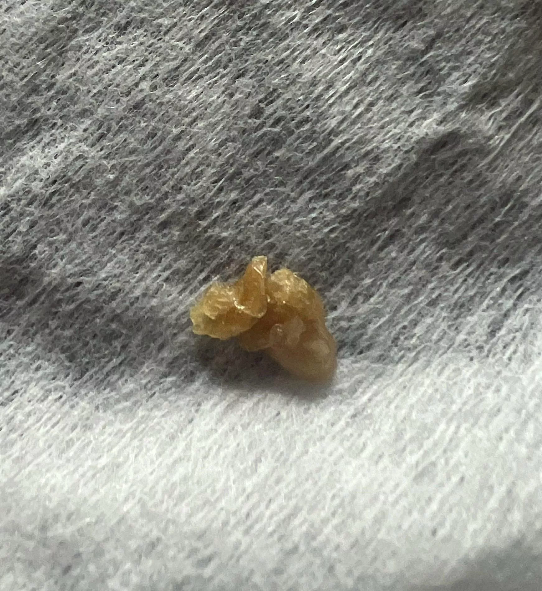 Plucked this out of my 9 month old’s nose this morning posted by Serendipityyy