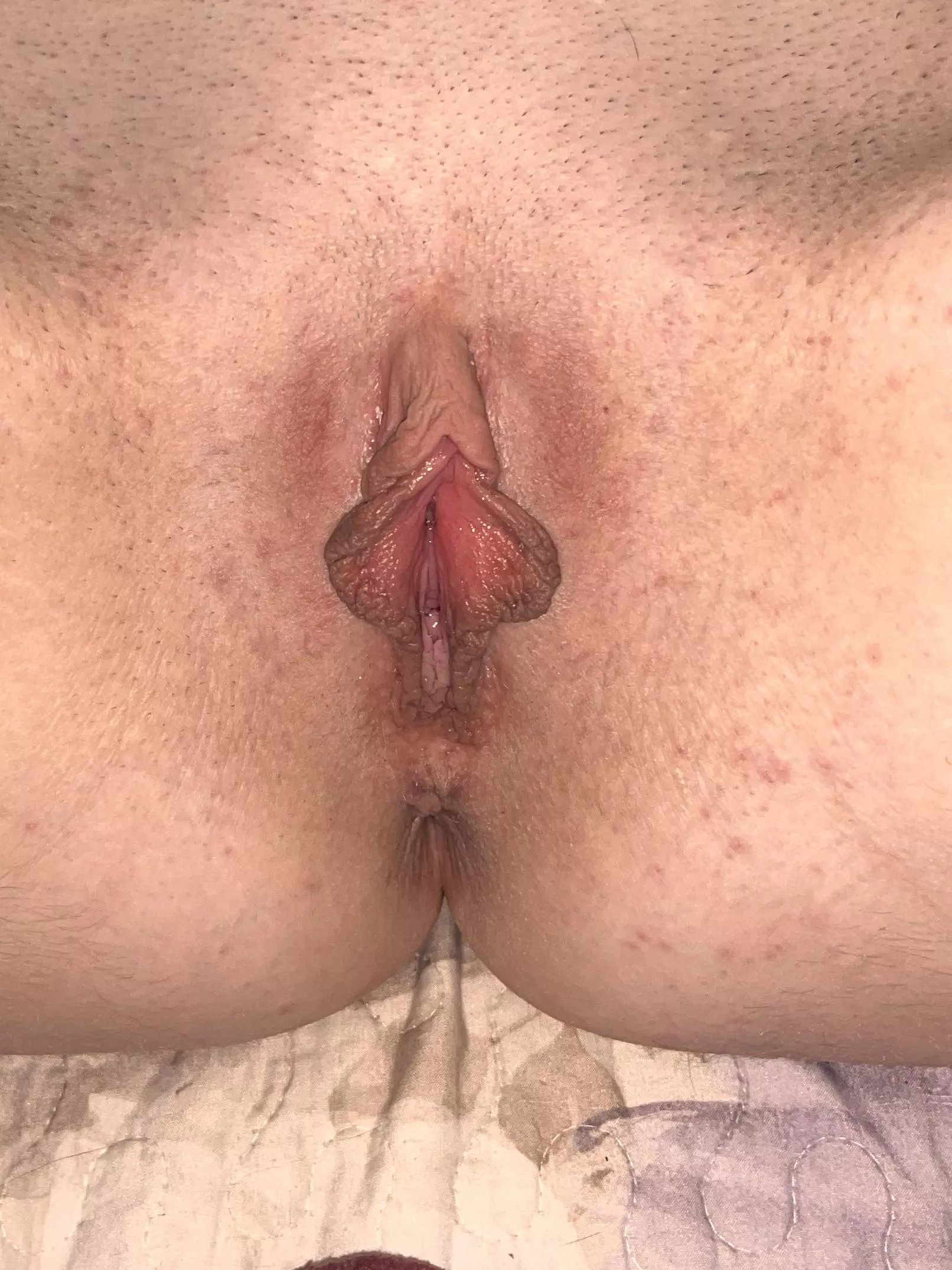 my droopy clit loves being sucked and bit  posted by sluttyroastpussy