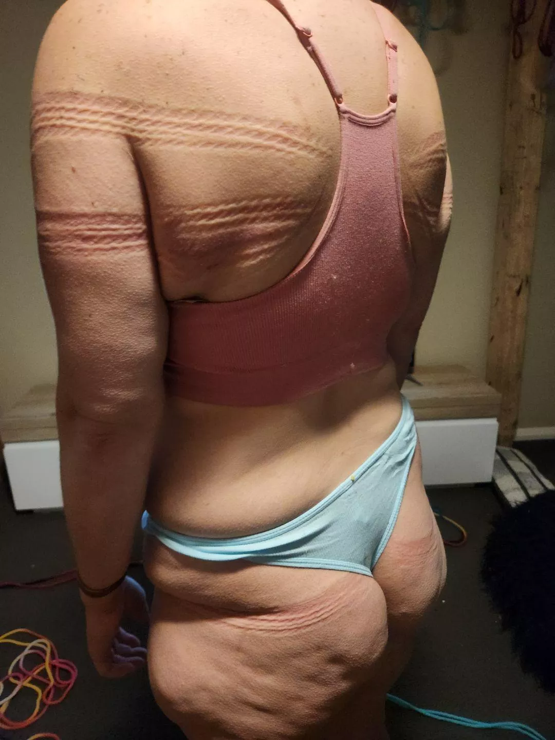 Rope marks  posted by sunlollipop123