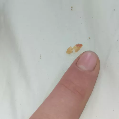 This piece of wax was right on my eardrum for years and I finally got it (the relief omg) by bill_loney538