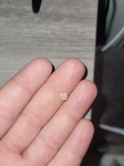 Woke up to this moster sitting in the back of my throat by ImYourKitchenSink