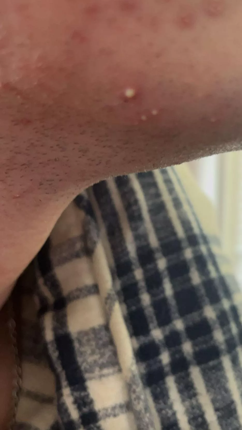 wowzers that’s taunting posted by Wise_Mongoose_2587