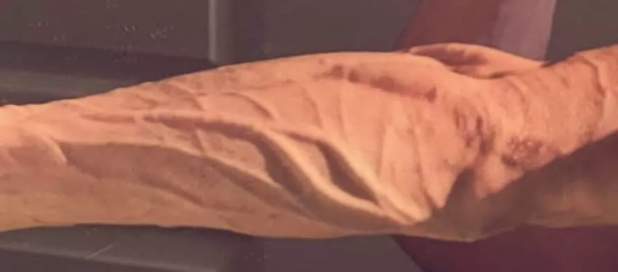 2nd post  posted by Capable-Ability5863