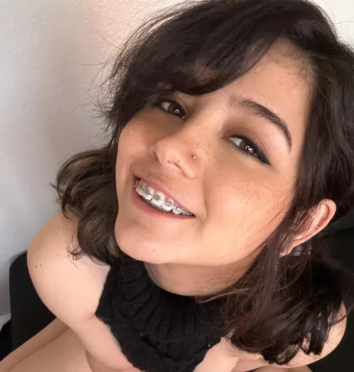 finish on my braces? by PupFiggy