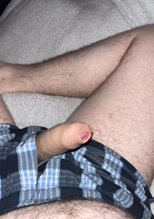 Must have slipped out by Charming-Coat-8705