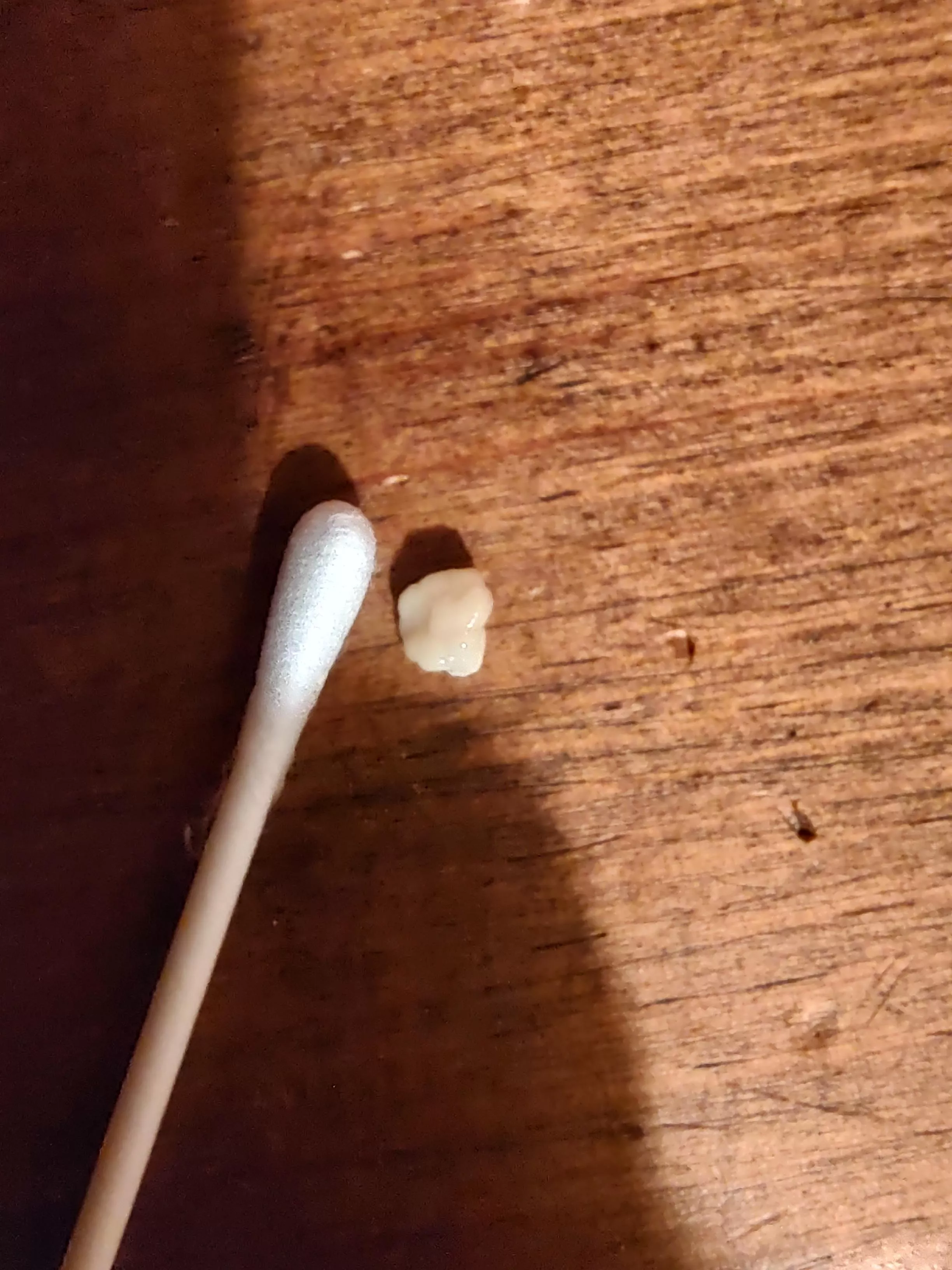 Tonsil stone I coughed up just now, qtip for scale posted by babyblazey