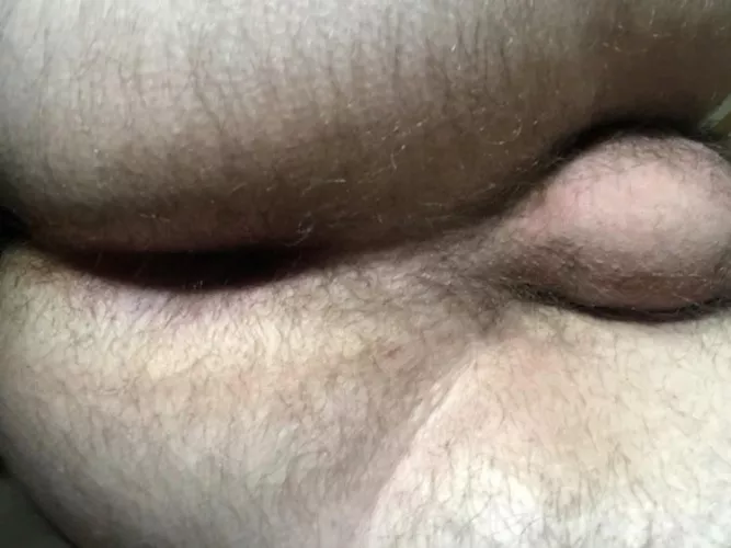 Hairy enough?  by Classic_Parsley_8806