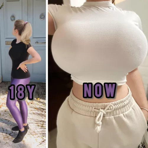 What about this 8 year comparison? My boobs grew almost a cup per year!  by Longjumping_One5379