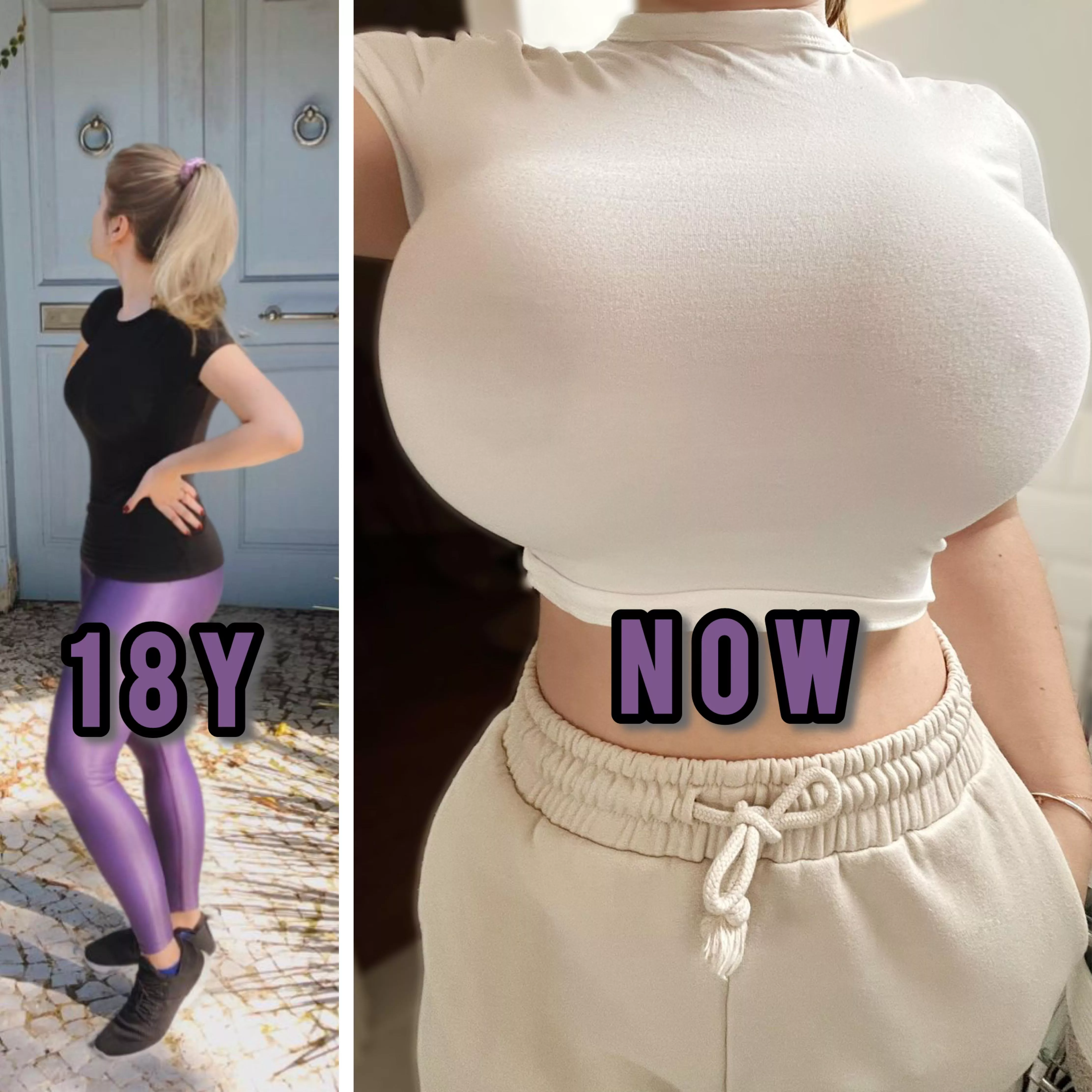 What about this 8 year comparison? My boobs grew almost a cup per year!  posted by Longjumping_One5379