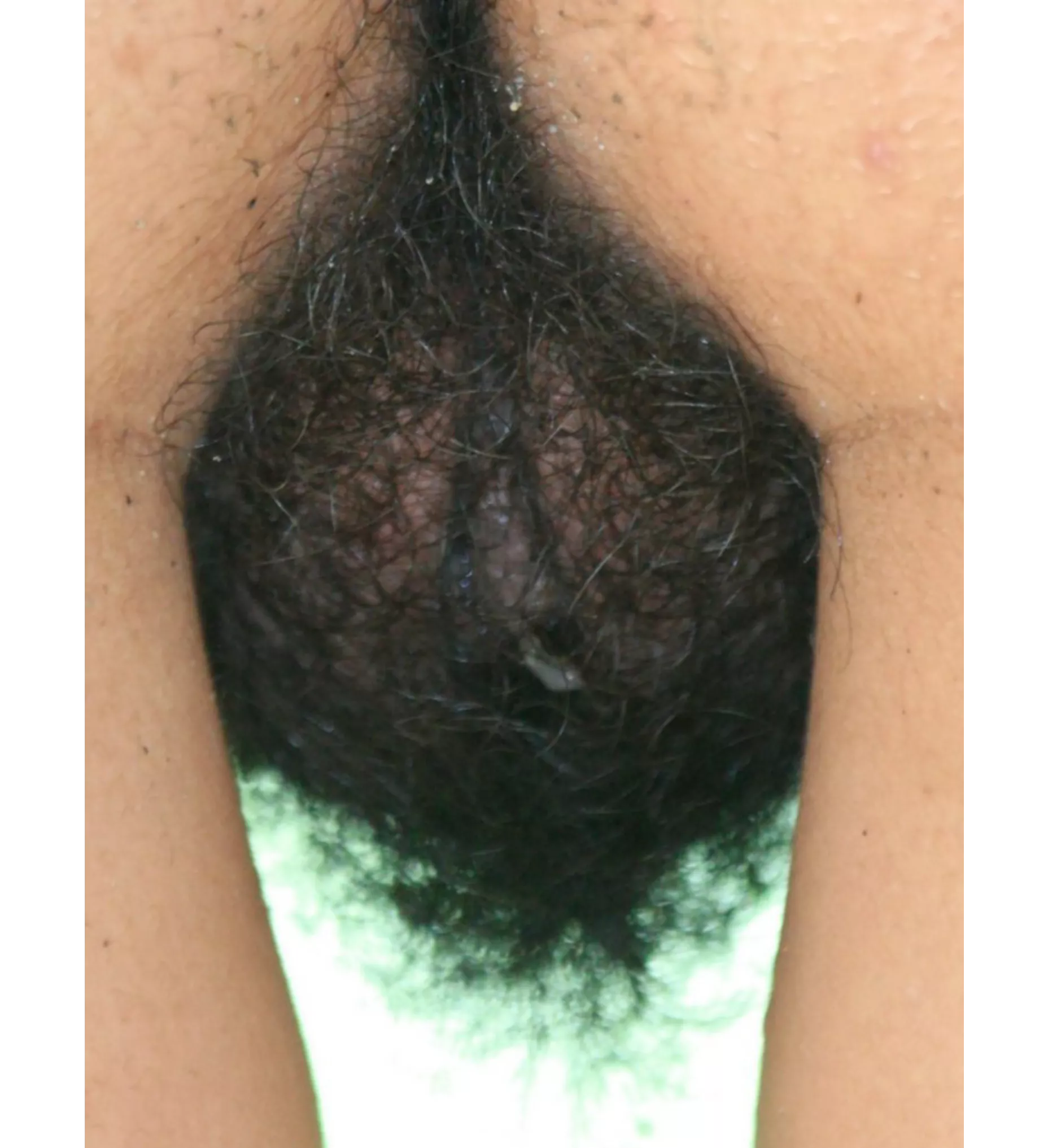 130 mm Apochromatic Quadruplet Refractor posted by Shibui4444