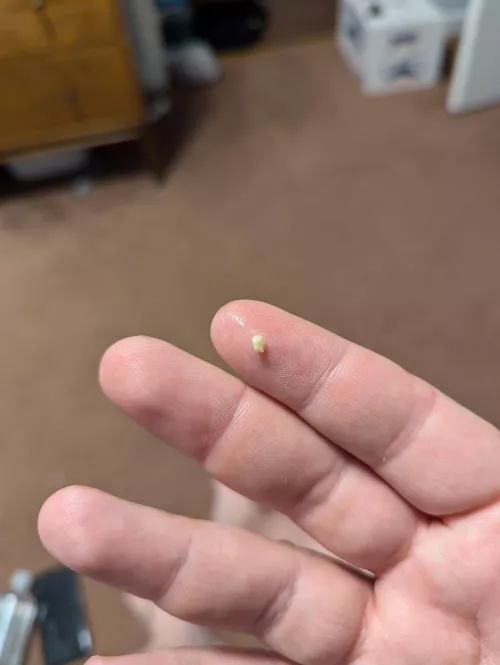 First tonsil stone in a long time. by fuzzyrugby