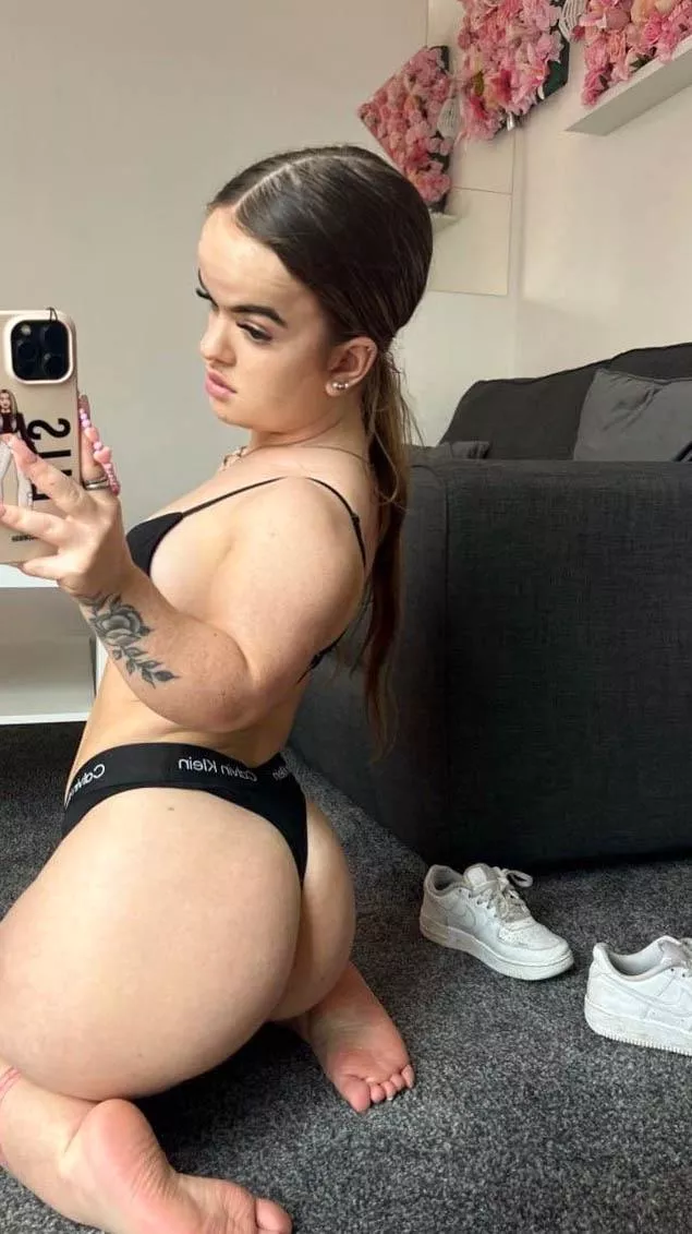 I love my dwarf feet because they look so cute posted by LuminousLeopardk