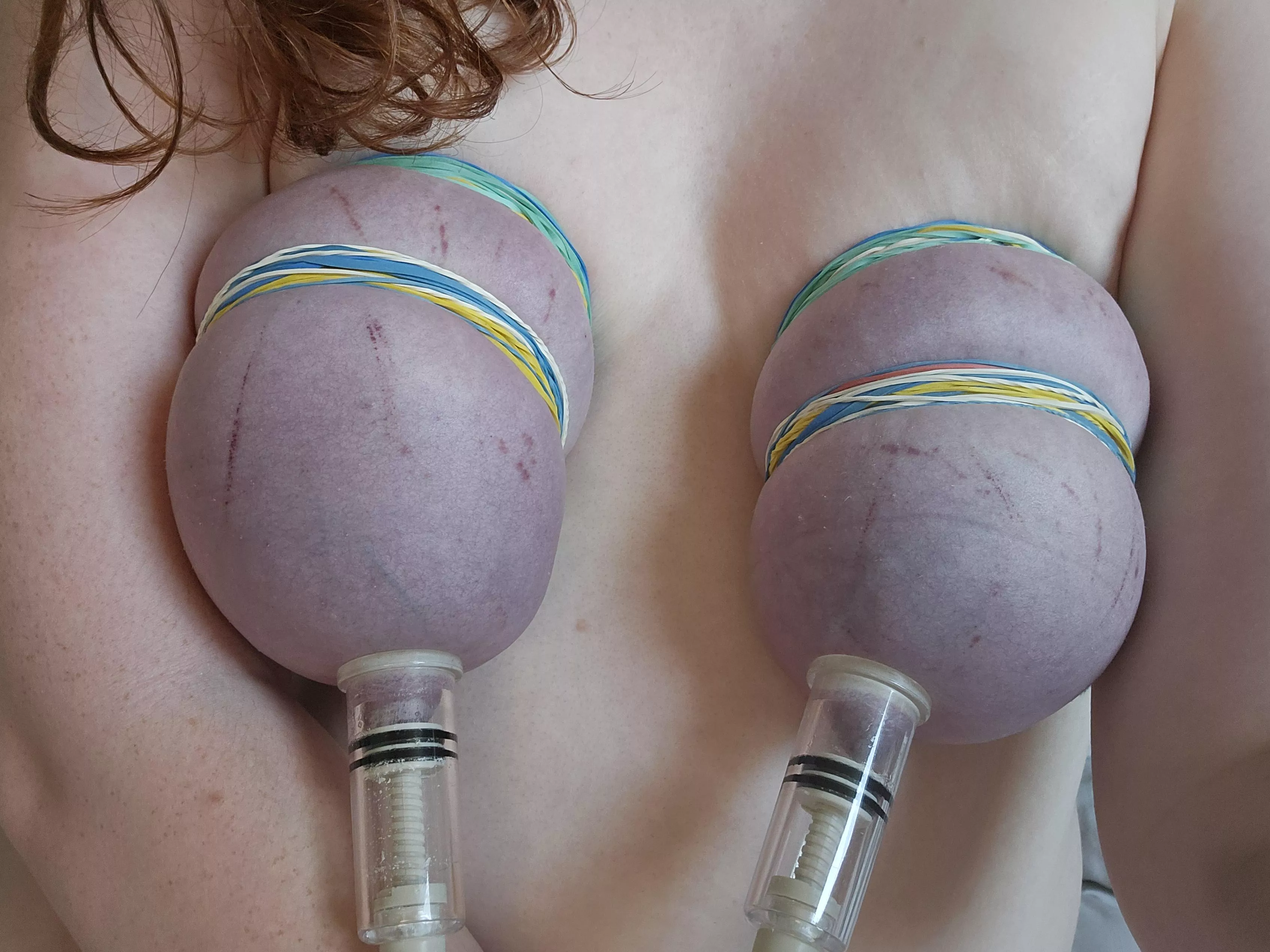 Master says my tits should always be tightly bound, bruised, or both posted by Gingerbaby2003