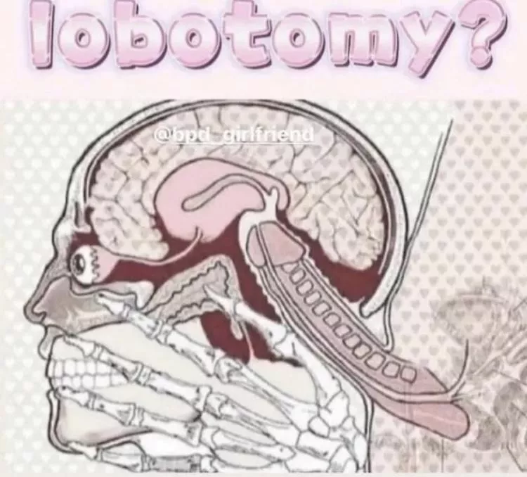 Lobotomy posted by Modelfucker69
