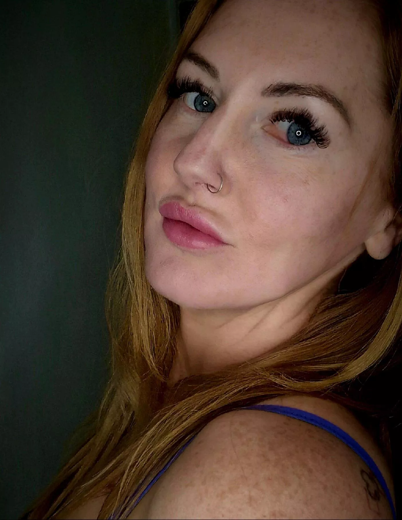 Freckly shoulders [IRTR] posted by clarrisacrystal