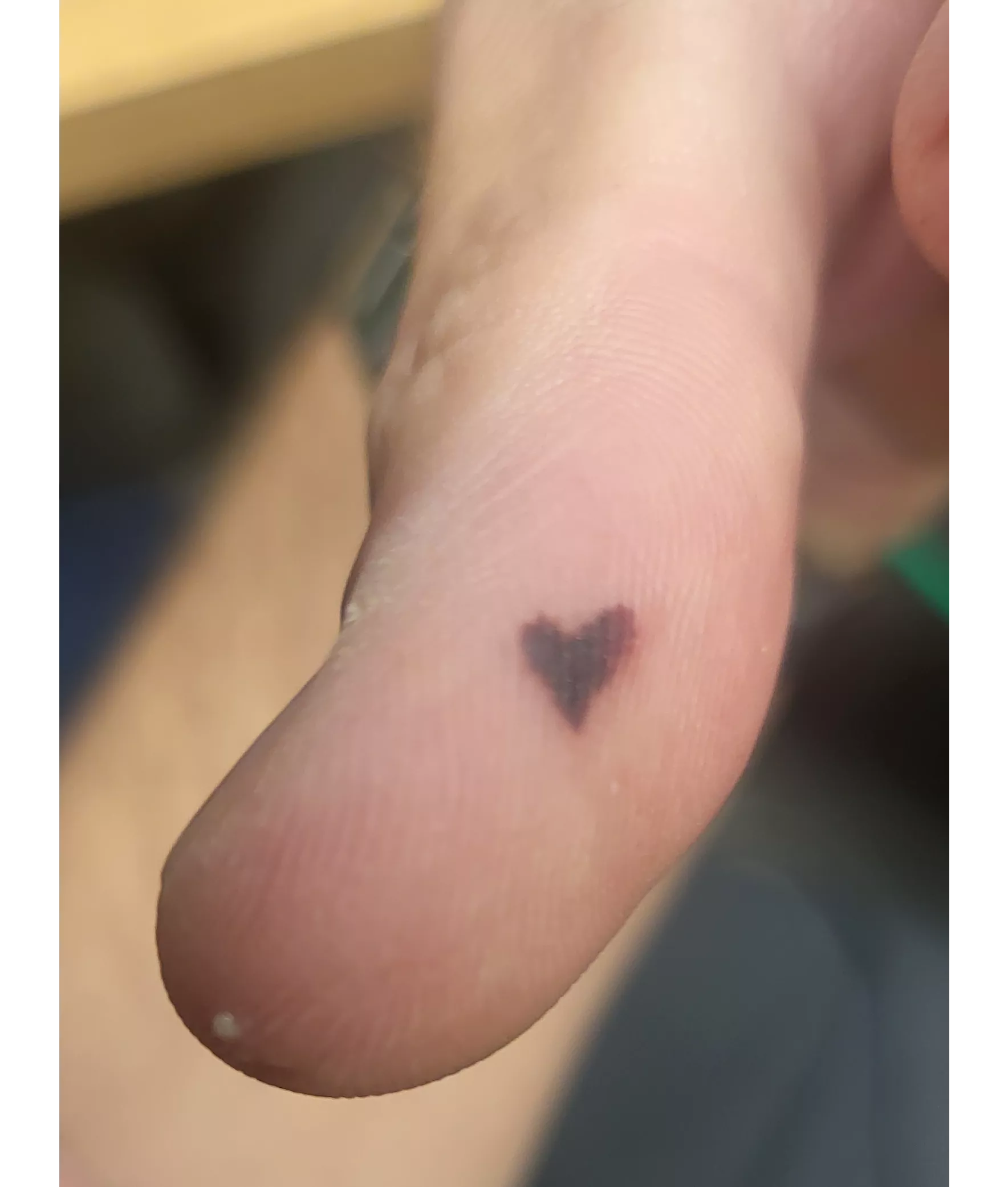 Heart shaped blood blister posted by Caddacus