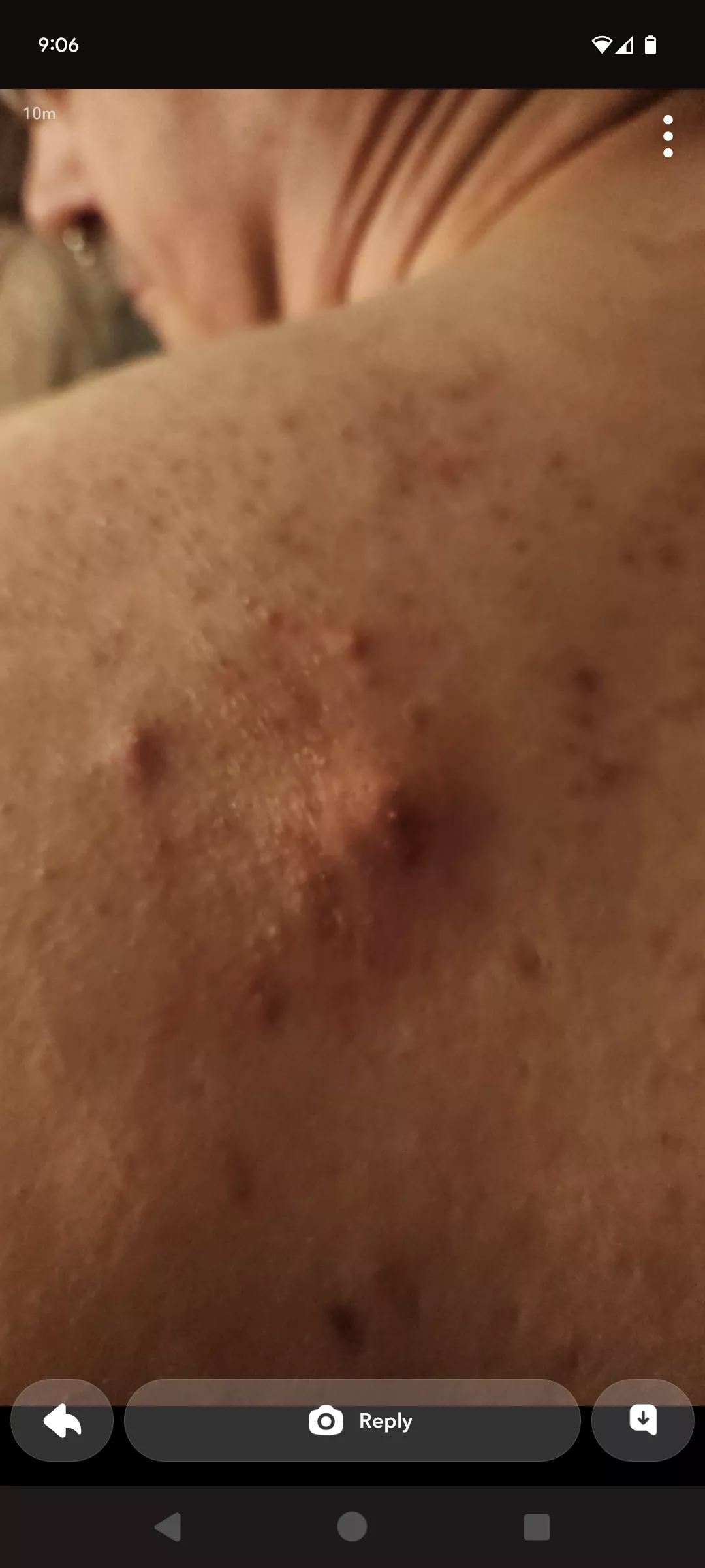 This guy and friends are brutalizing my back. posted by ImSmilingSimon