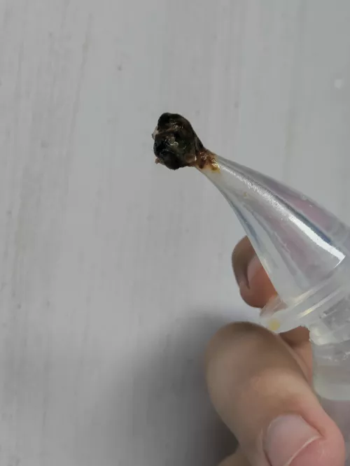 My boyfriend had a clogged ear. Flushed it and this bad boy came out  by Probably9Fruits