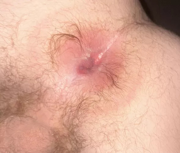 18 year old virgin ass… to shave or not to shave?? by redhotnhole