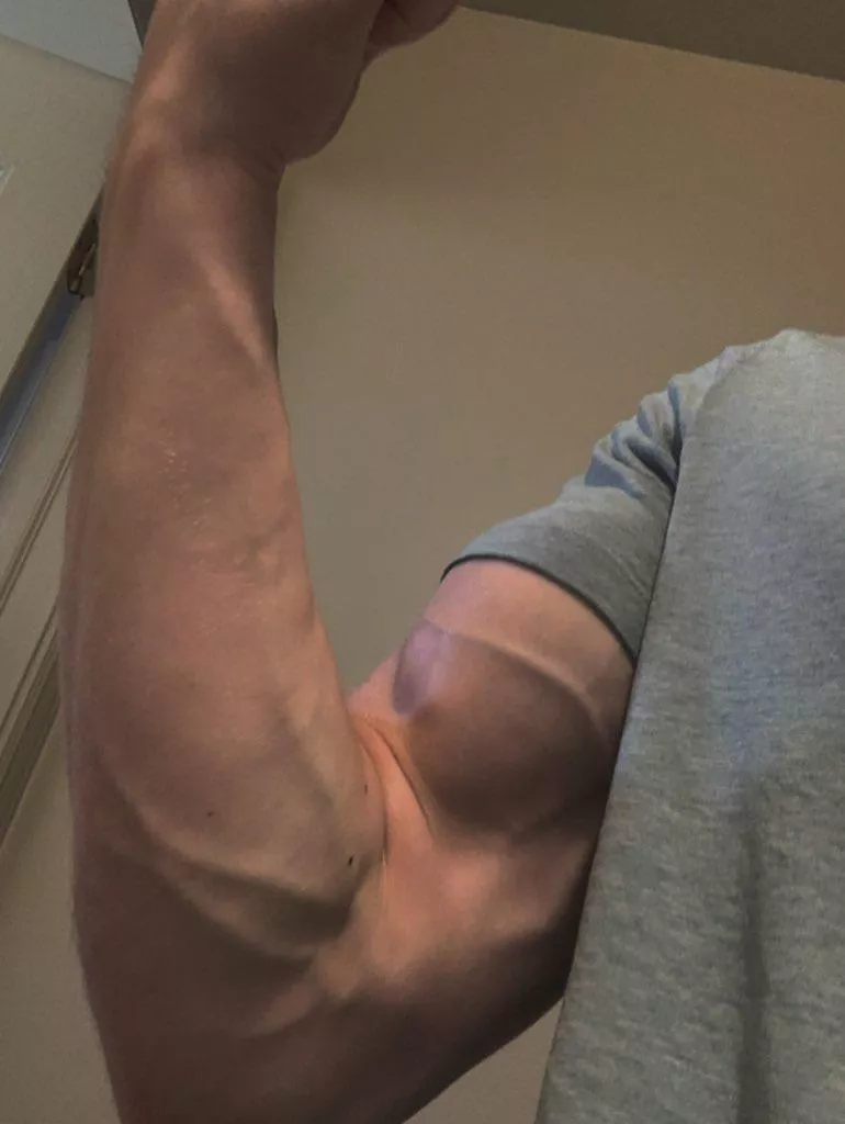 Hey there posted by Lucas-Luke