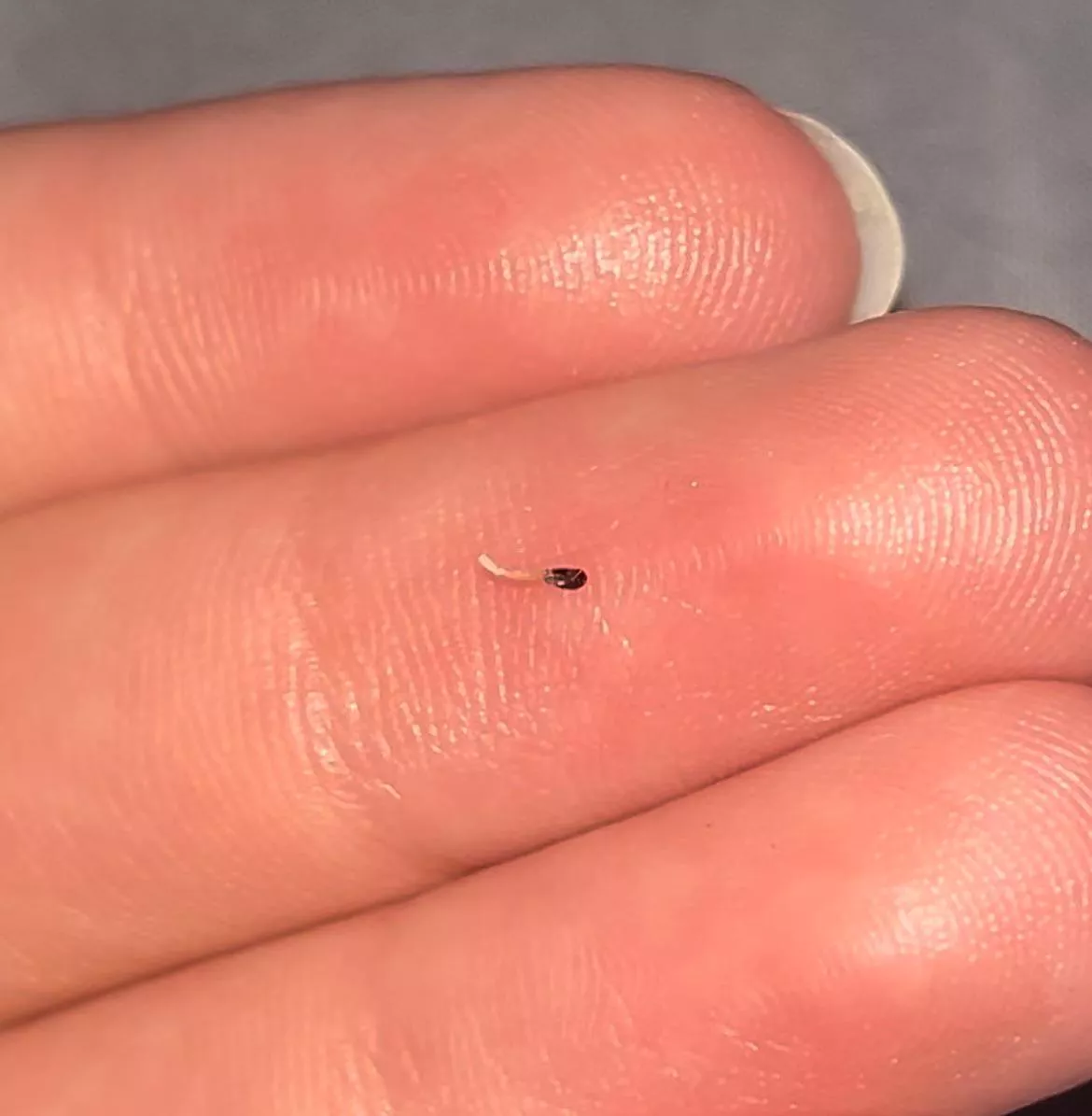 Sharp nail (?) thing poking through scalp posted by kewife