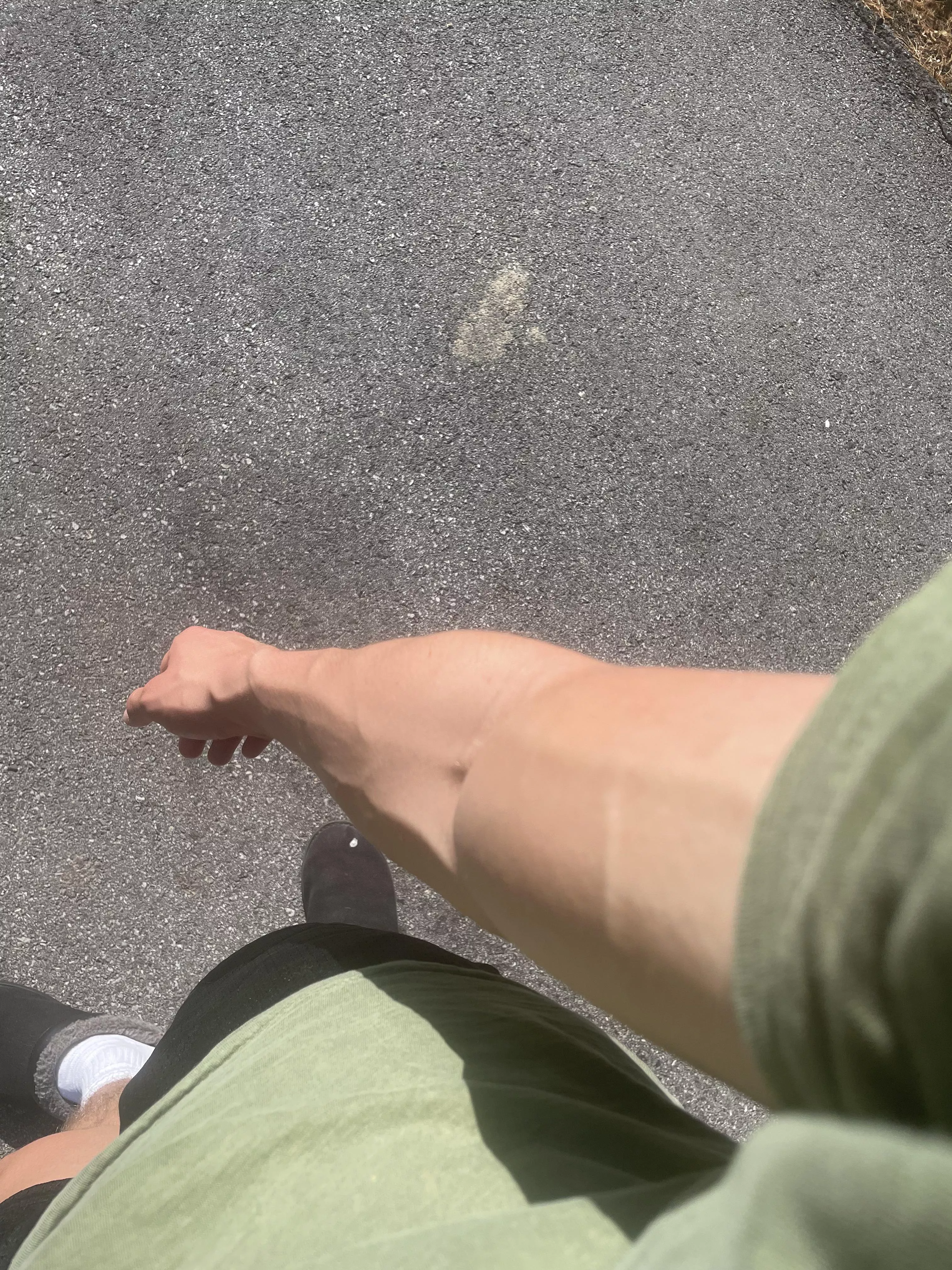 Veins go crazy! posted by [deleted]