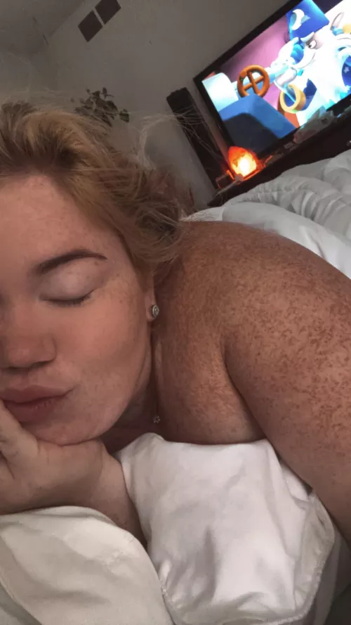 Woke up and noticed my shoulder freckles are popping out! [IRTR] by Redsnapperr69