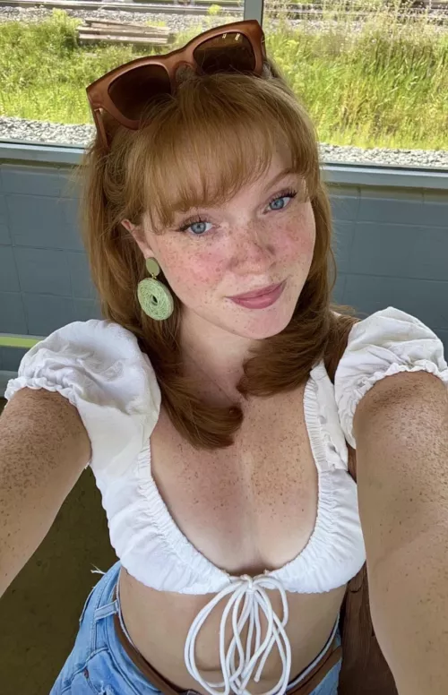 summer freckles by awfully-loud16