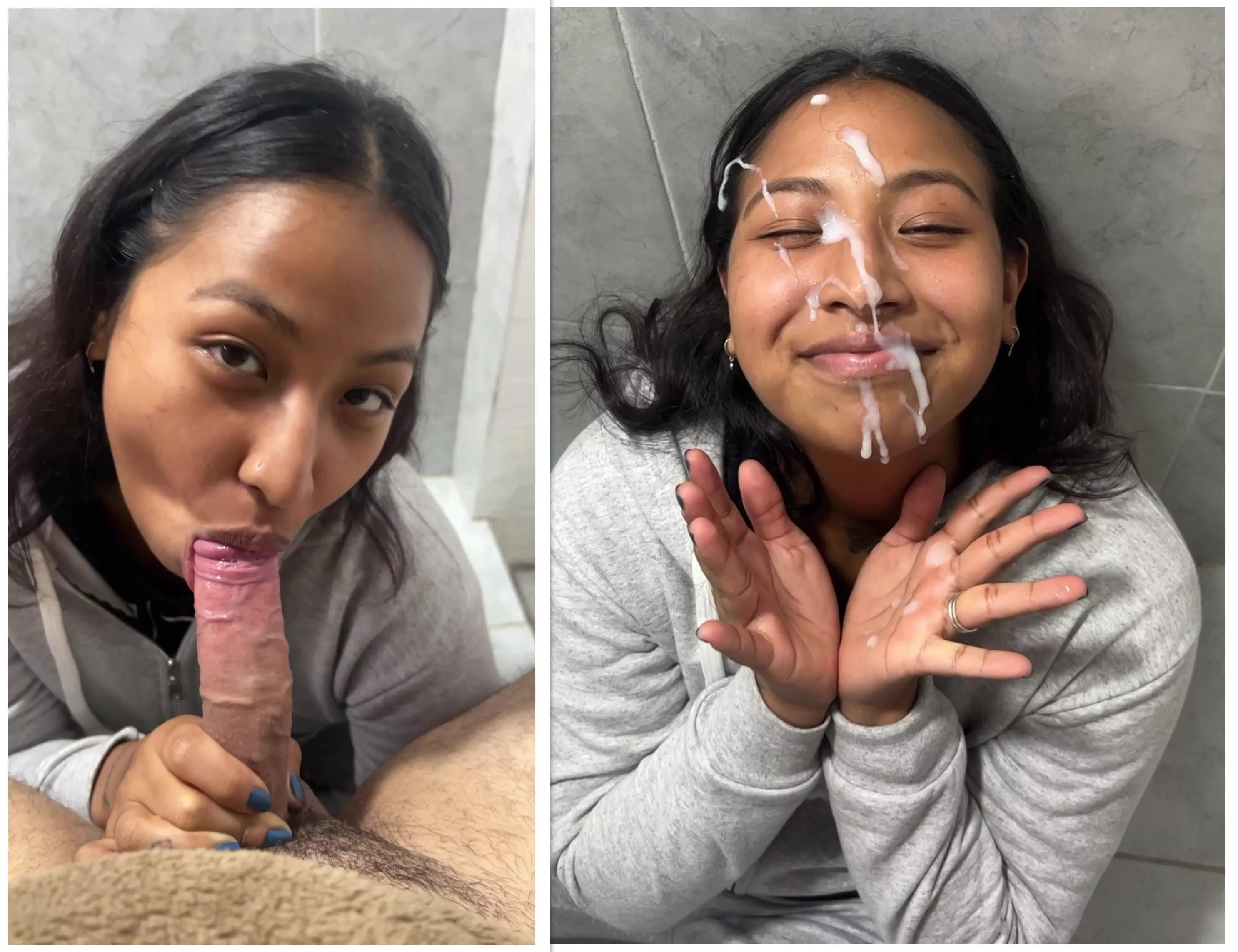 Happy white after on my face posted by Theloversvip2