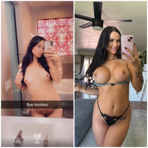 the night before my surgery VS 4 years later by wild_booty_princess