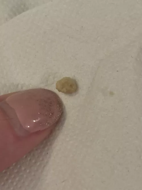 Lil nugget I chucked while sneezing. Haven't seen one of these in a long time! by 0ddlySatisfiedAnon