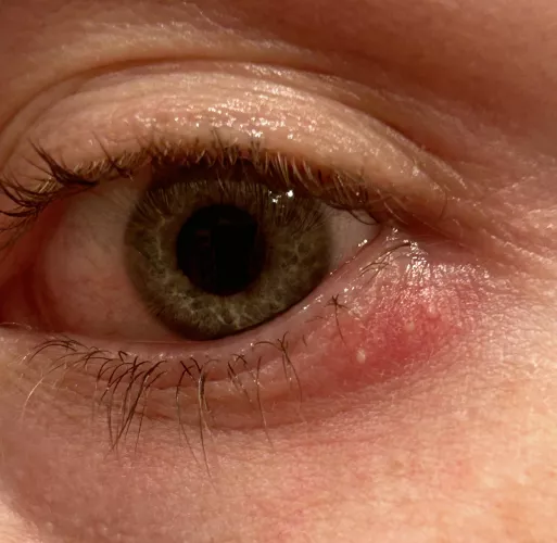 forbidden eyeball adjacent pop trio (... but I'm considering it) by allgoaton