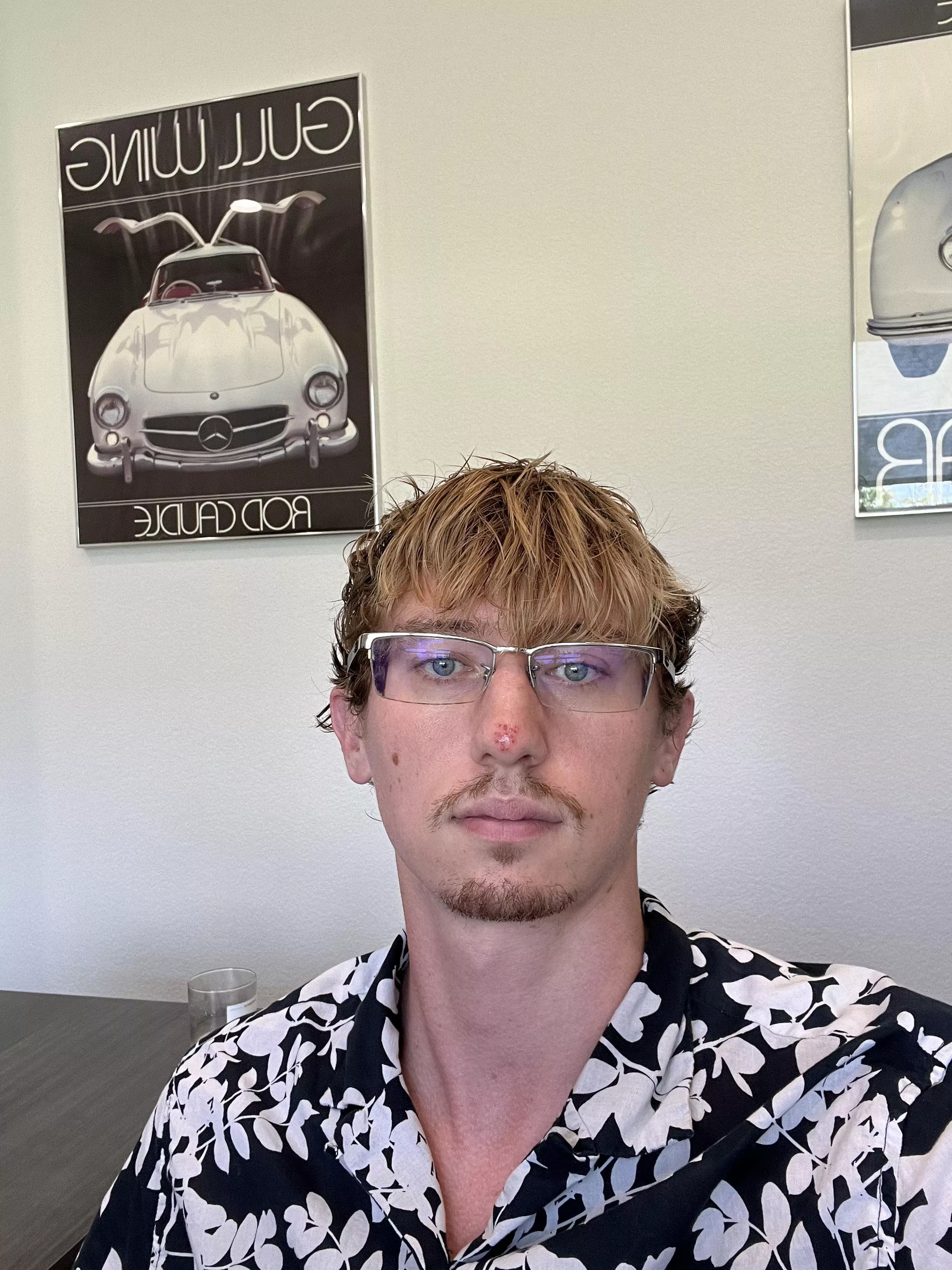 24hr Update* Forbidden pops on nose  posted by Temporary-Call-5811