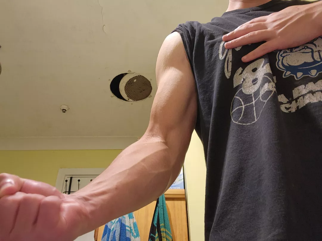 Modest tennis forearm for you posted by Radiant_Hold_3606