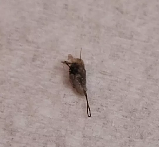 This is what came out of a bump on my thigh. Wish I had recorded; the pop was audible. by agent_scully2084