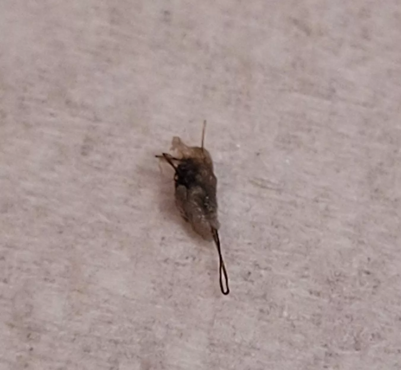 This is what came out of a bump on my thigh. Wish I had recorded; the pop was audible. posted by agent_scully2084