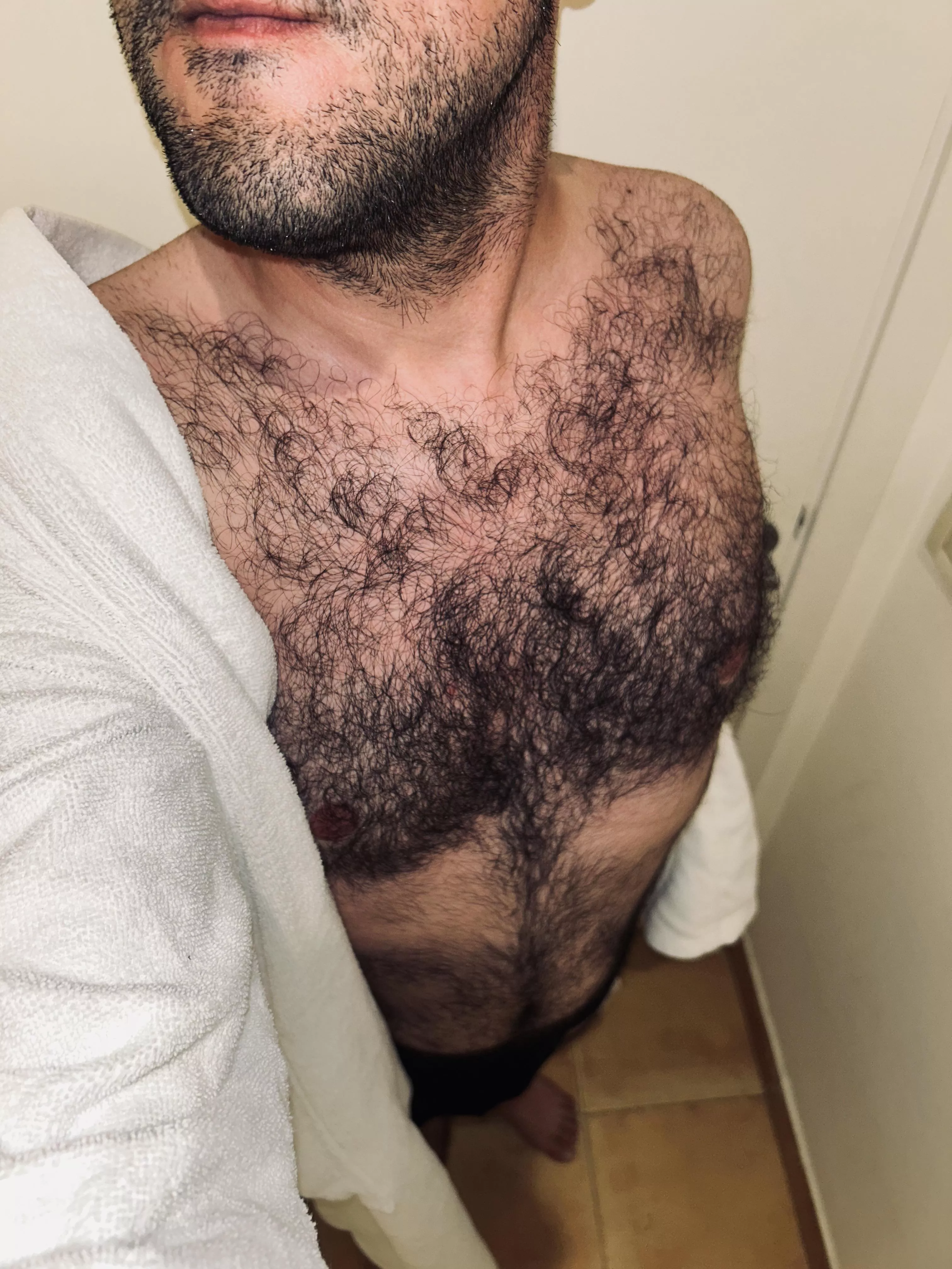 Of course you can be hairier  posted by Anxious_Ananas_643