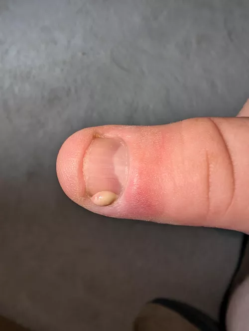 The relief was immense by friendlypelican