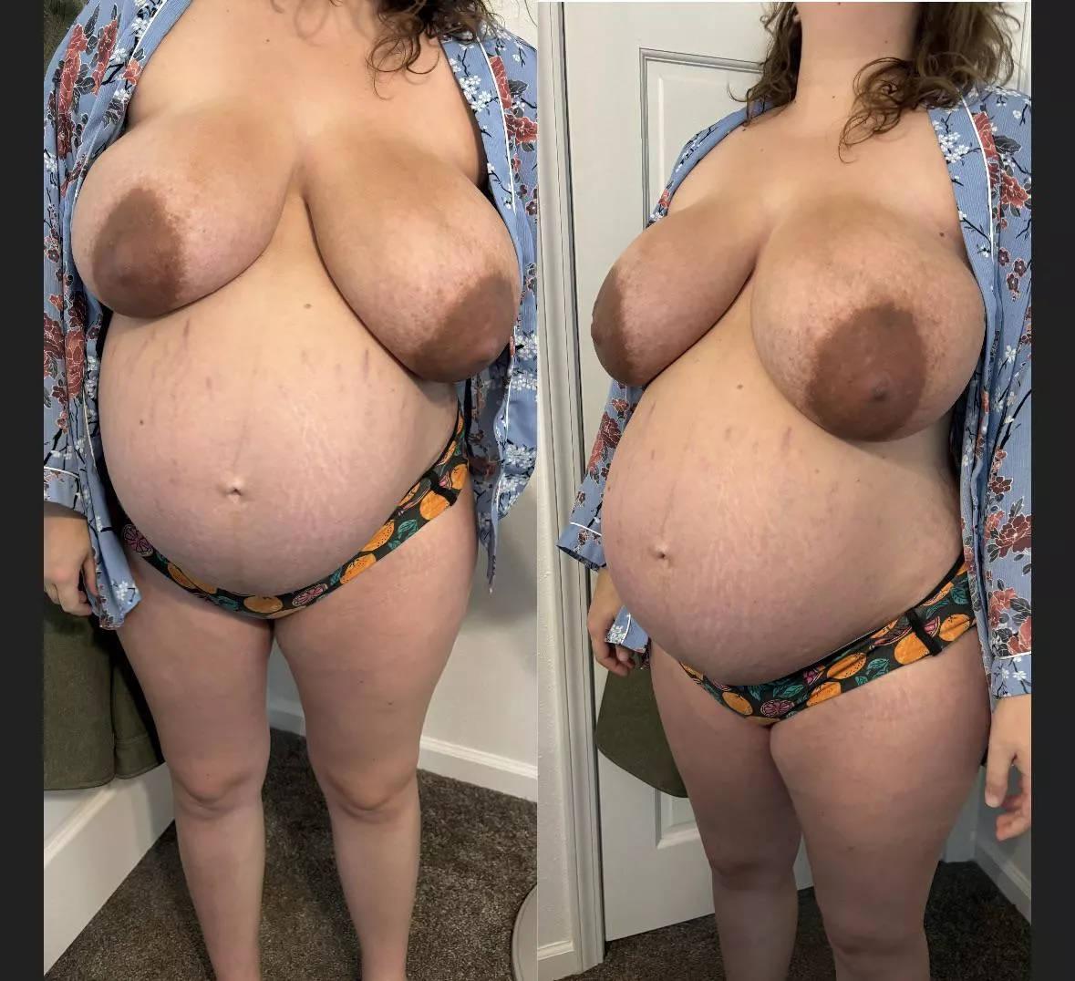 They’re starting to get swollen and engorged! They hurt!  posted by blankskater1992