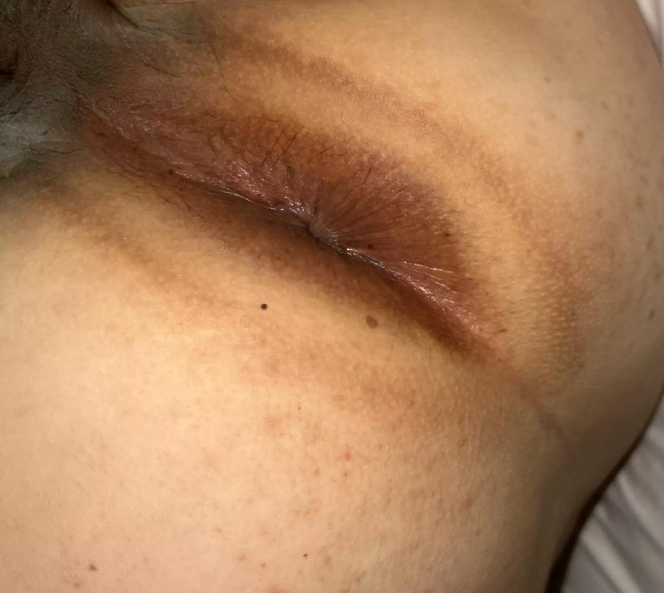 Would you ?? 😉  posted by GlitteringLevel3613